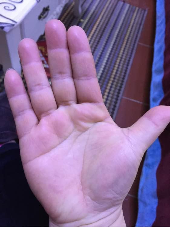 手掌先知手掌中间长黑点小心脾土位九