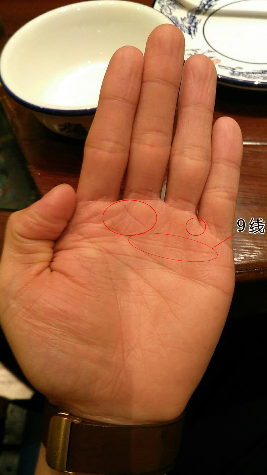 手掌先知:鼻炎的掌纹有哪些共同点[案例分析]