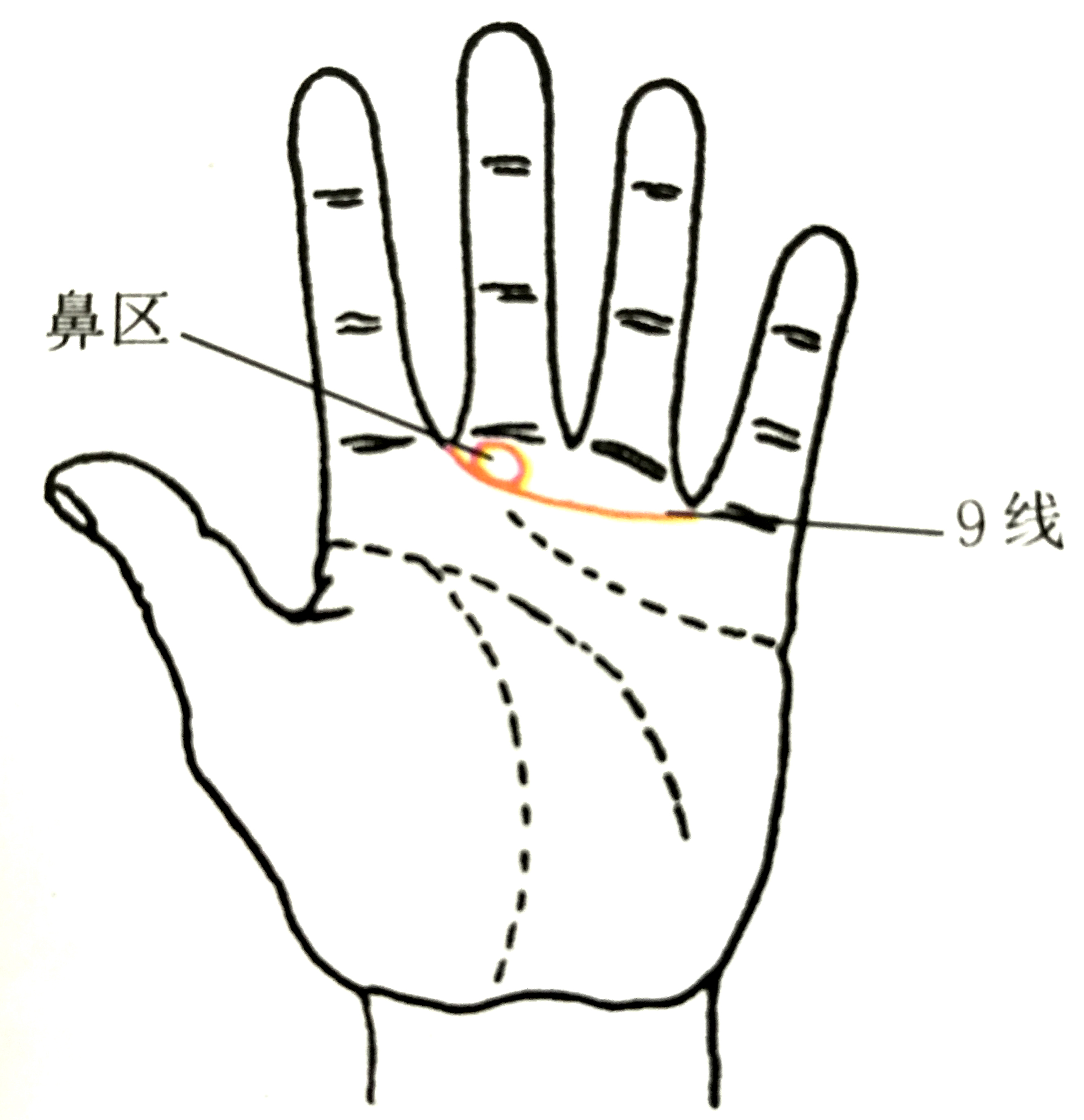 2,鼻区有十字纹或竖纹.1,有9线出现,或有形成9线的趋势.