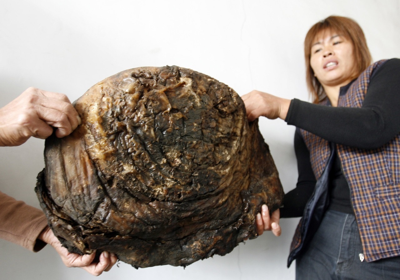 凤凰网健康_凤凰网