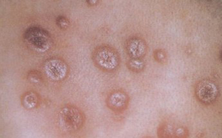 生活中你可以这样消除扁扁不复发