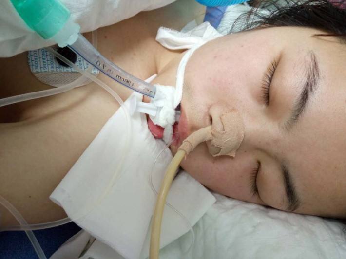 女儿惨烈车祸,前男友跨洋伸出爱心,耗尽百万只为救我的女儿