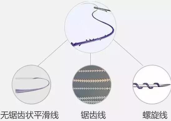 线雕| 1厘米的提升,整张脸都年轻了!