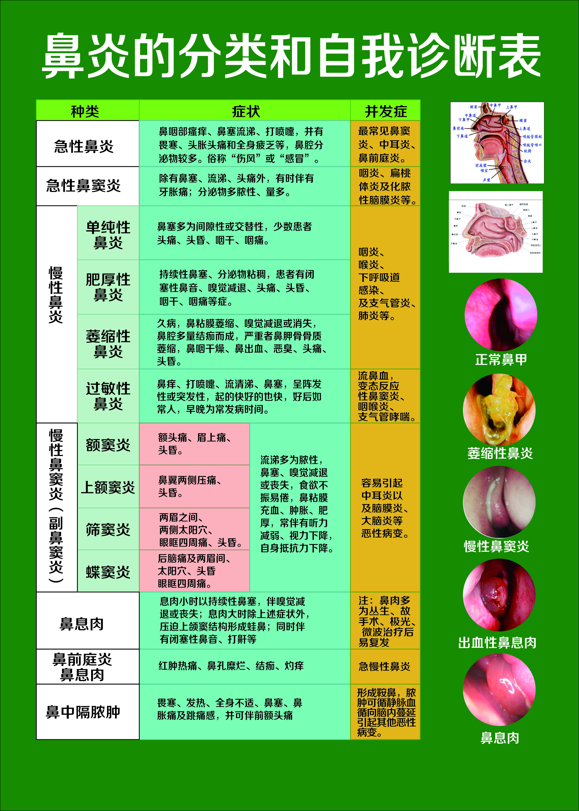 鼻炎自我诊断分类表_凤凰网健康_凤凰网