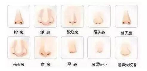 翘用假体和自身组织做自然美丽适合你的鼻部整形将面部的中心鼻子隆高