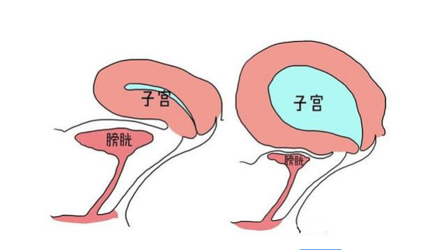 内分泌健康尿道炎症