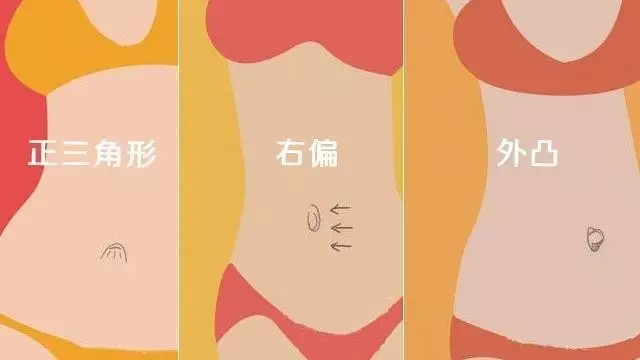 我们其实可以通过观察肚脐眼的形状和位置,来了解自己的肠胃是否健康