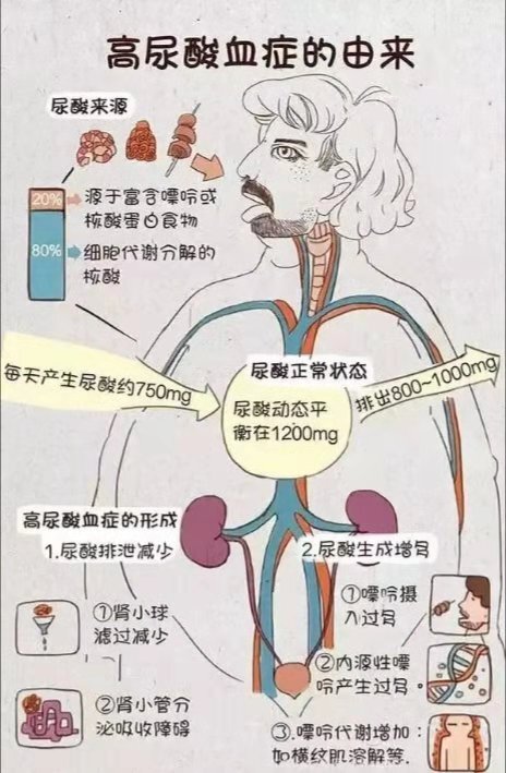 高尿酸是怎么产生的?哪些因素会引发痛风急性发作?__凤凰网