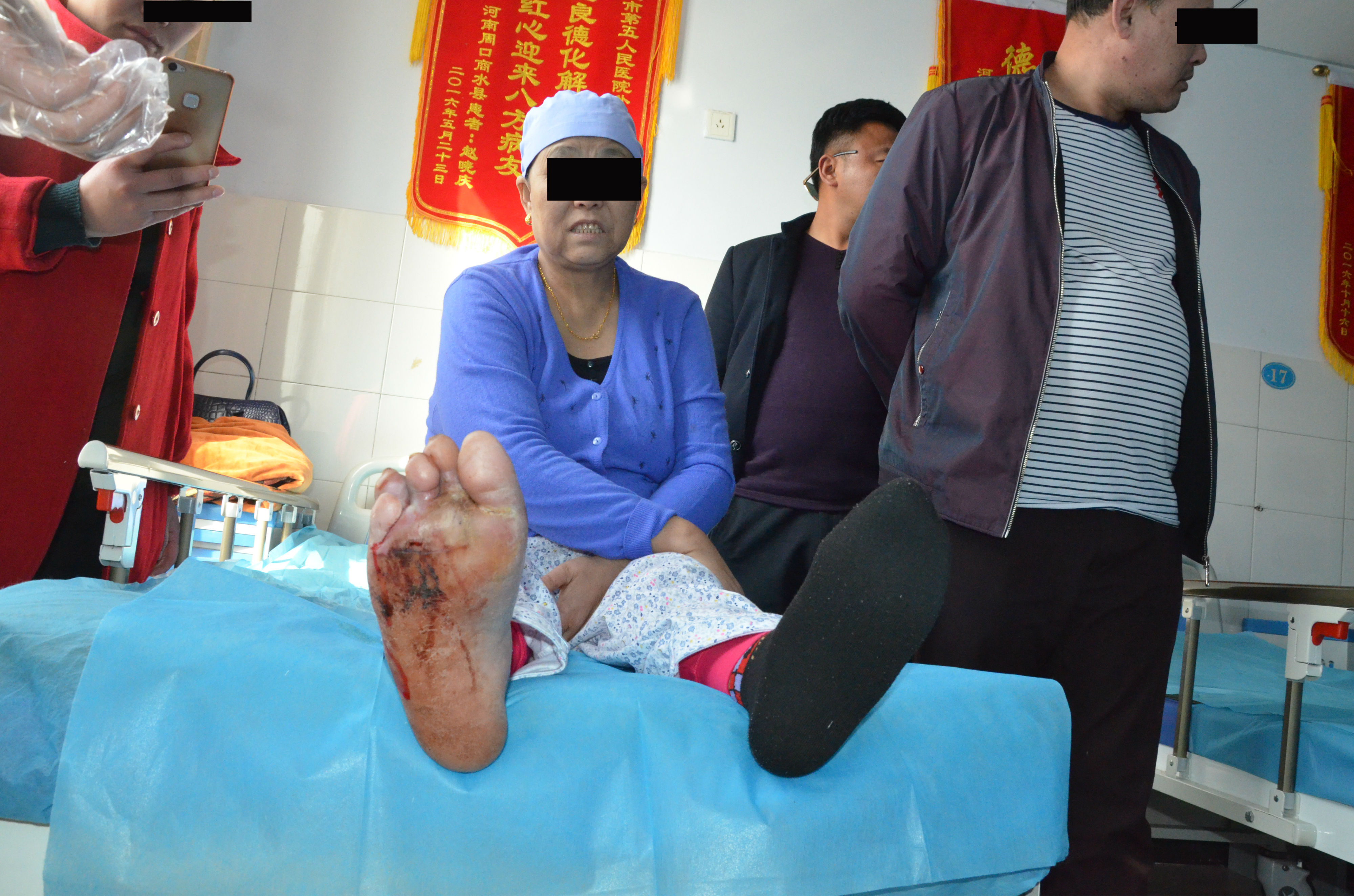 糖尿病患者如果出现了烂脚,应该怎么做