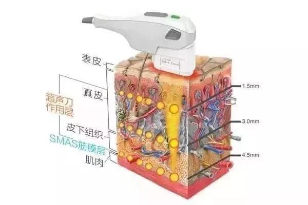 做完超声刀后的注意事项?__凤凰网