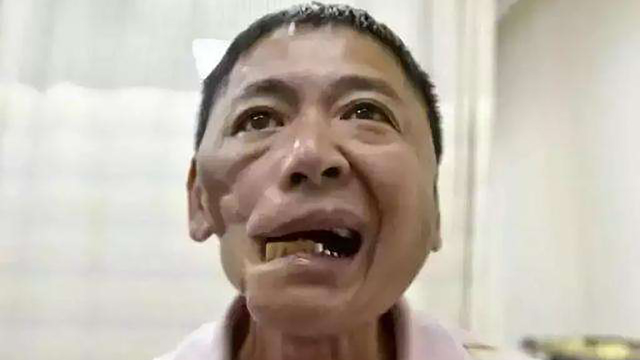 他们被割掉舌头切去牙床用生命告诉世人这个事实