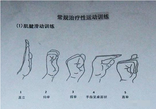 程序员怎么面对腱鞘炎?__凤凰网