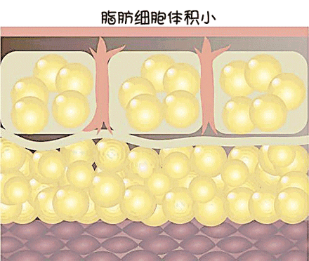 肥   脂肪导致 真"胖"