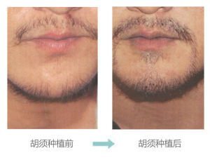 不同的脸型适合哪种类型的胡须呢?__凤凰网