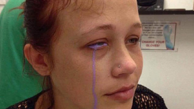 女模特在眼球上纹身流出紫色眼泪导致视力严重受损