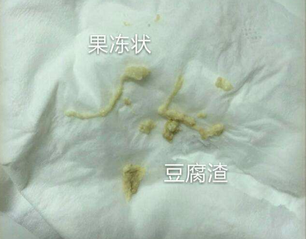 子宮病了,小內內會有黃斑,血絲,豆腐渣狀物質,散發醋酸味