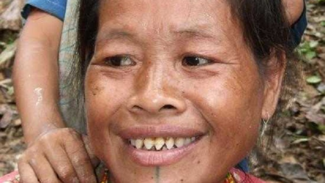 世界上牙齿最尖的人图片
