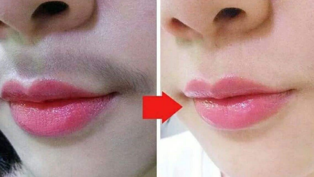 女人长唇毛太难看学会阿姨教我的小妙招轻松去除小胡子实用