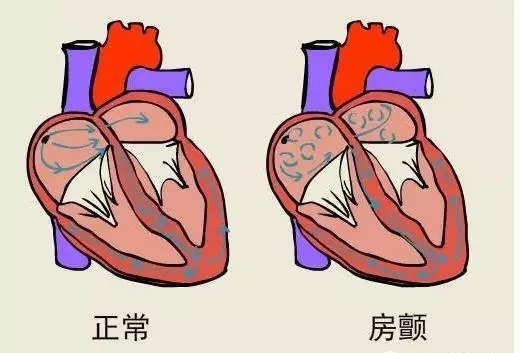 血管里搭载的红细胞了,他们被不停的颠簸打颤,四处乱窜,形成血液涡流