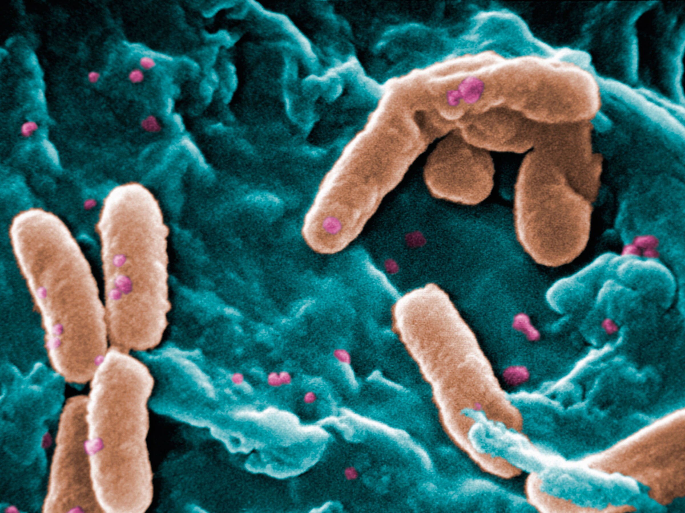 连线科学家首次通过基因改造病毒拯救了一位重病少女