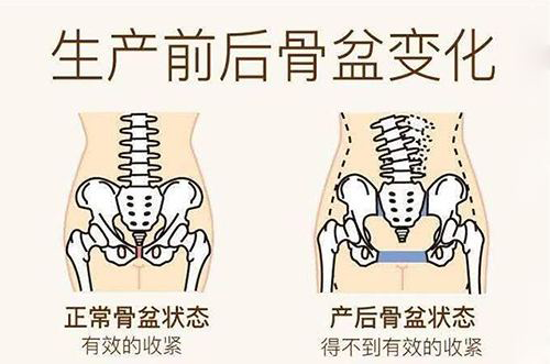 促进阴道收缩,防止松弛(产后14天开始); 9,子宫收缩运动:避免子宫位置