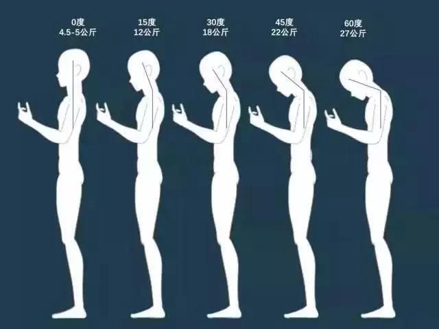 "低头族"成为颈椎病的"主力军"你中招了吗?