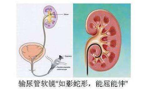这样做是最好的!