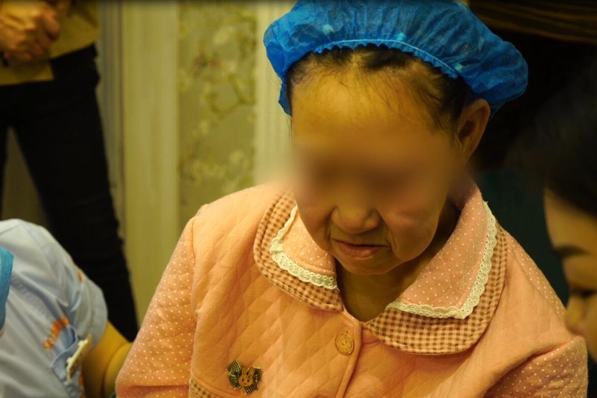 中国早衰症女孩图片图片