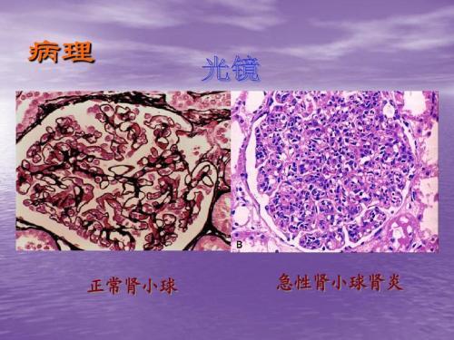 肾脏还分泌肾素,红细胞生成素,前列腺素,活化维生素d等