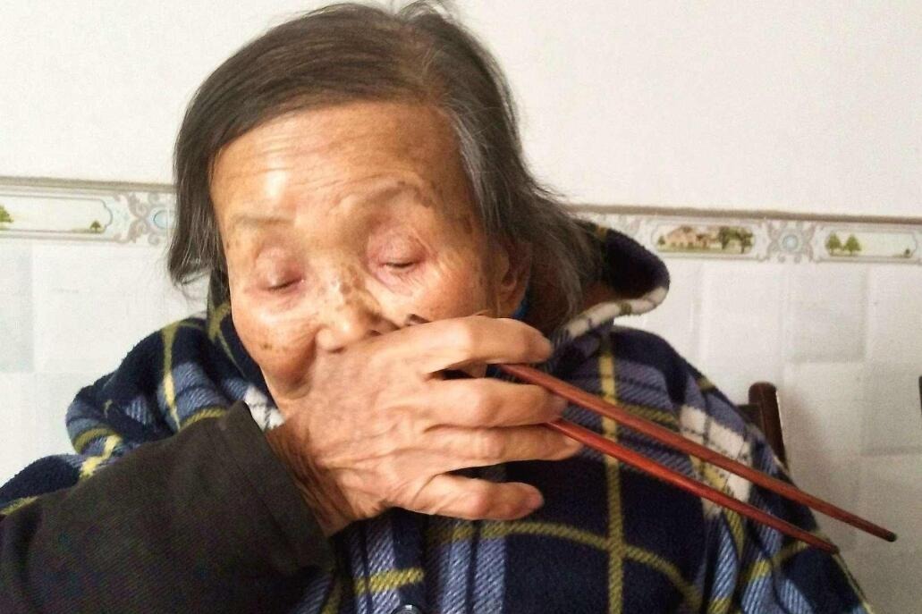 老奶奶患了帕金森手抖得厉害吃饭都困难
