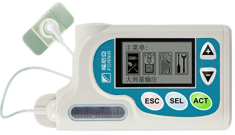 天泰小讲堂之五——胰岛素泵的基础率和大剂量如何分配