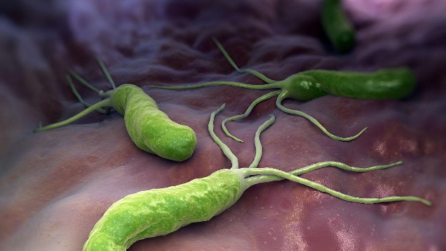 幽门螺杆菌是胃病的“助攻”，常吃一种抑菌食物，胃不痛，肠道通