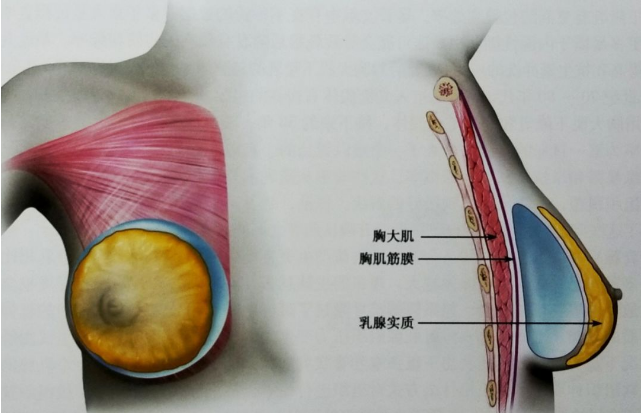 在北京哪種隆胸方式不會疼?