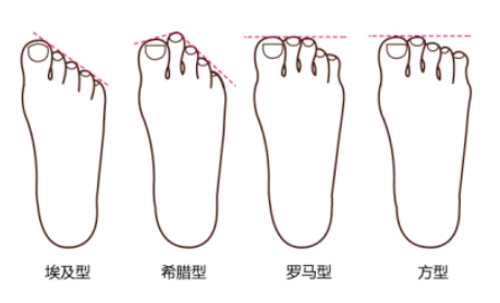 埃及脚、罗马脚、希腊脚……你知道自己是哪种脚型么？__凤凰网