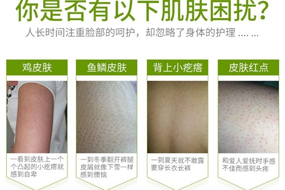 鸡皮肤的毒素(鸡皮肤是身体毒素堆积吗)