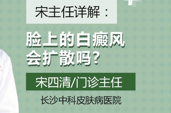 长沙中科白癜风医院宋四清医生介绍一般脸上的白癜风会扩散吗