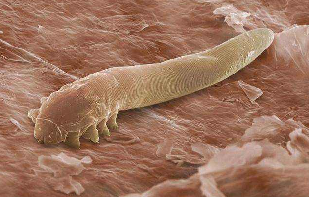 脸上有螨虫,除了出油,还有这些危害