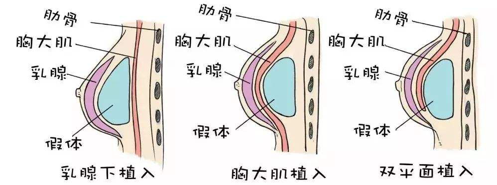 胸是什么中间图片