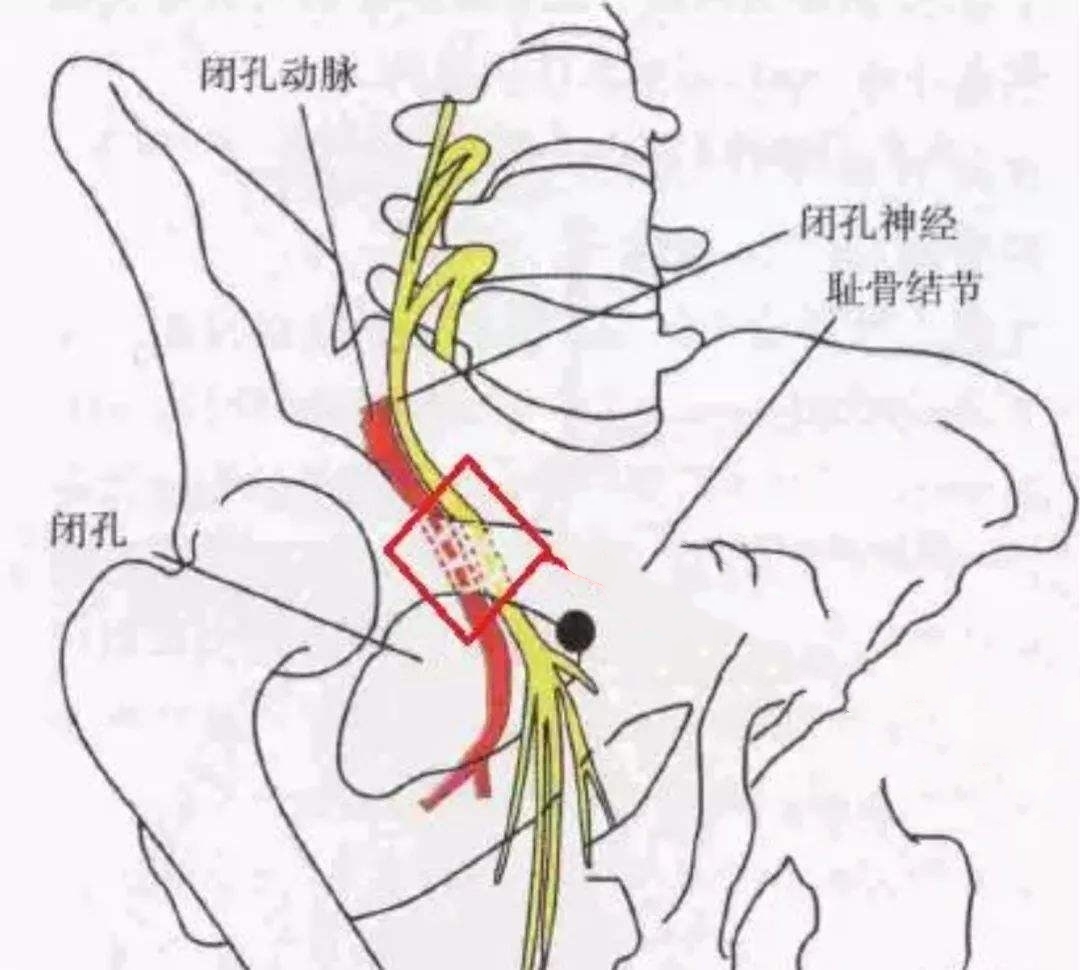 因为支配下肢的闭孔神经紧贴髋关节,再到膝关节内侧