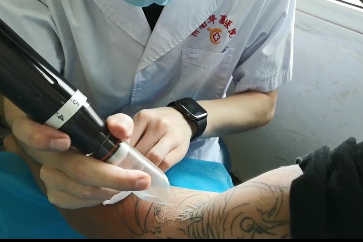 光感黑科技无创洗眉机 激光祛斑洗纹身仪器 大功率皮秒仪器
