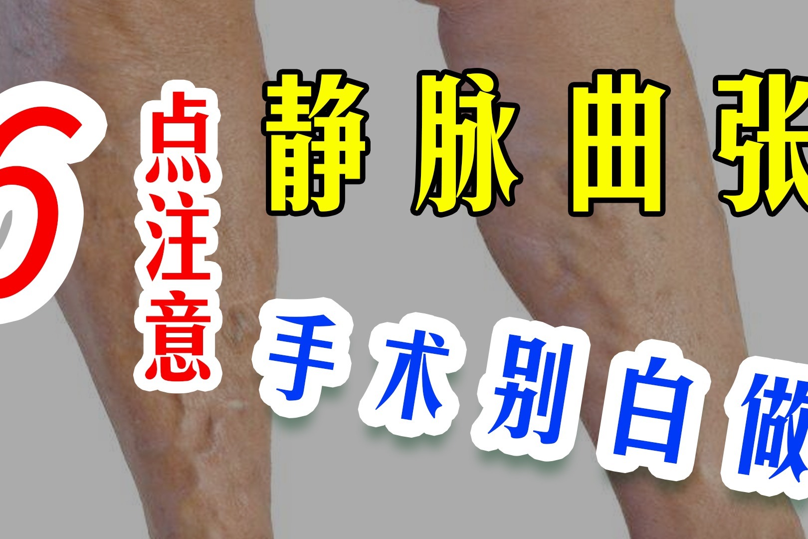 案例｜骨穿静脉反流导致的小腿皮肤病变 - 知乎