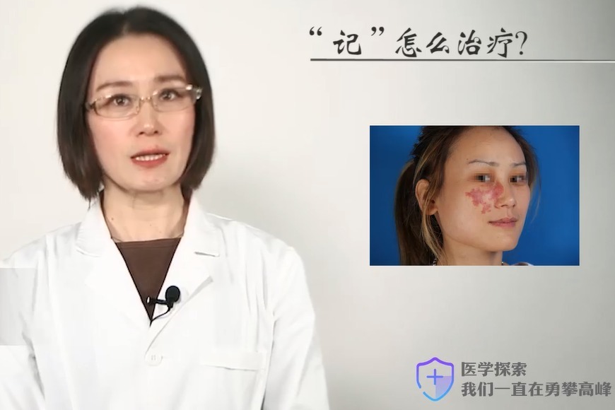 上海胎记医院上海长江医院肖萍主任:胎记如何治疗呢?