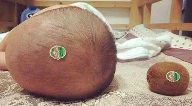 同样是新生儿,为何有的孩子头发浓密,有的娃却似"猕猴桃"__凤凰网