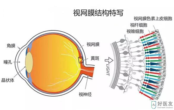 老人视力第一杀手：老年性黄斑变性！干细胞技术，助患者重见光明__凤凰网