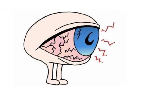 视力下降不一定是近视21岁大学生误把圆锥角膜当近视险失明