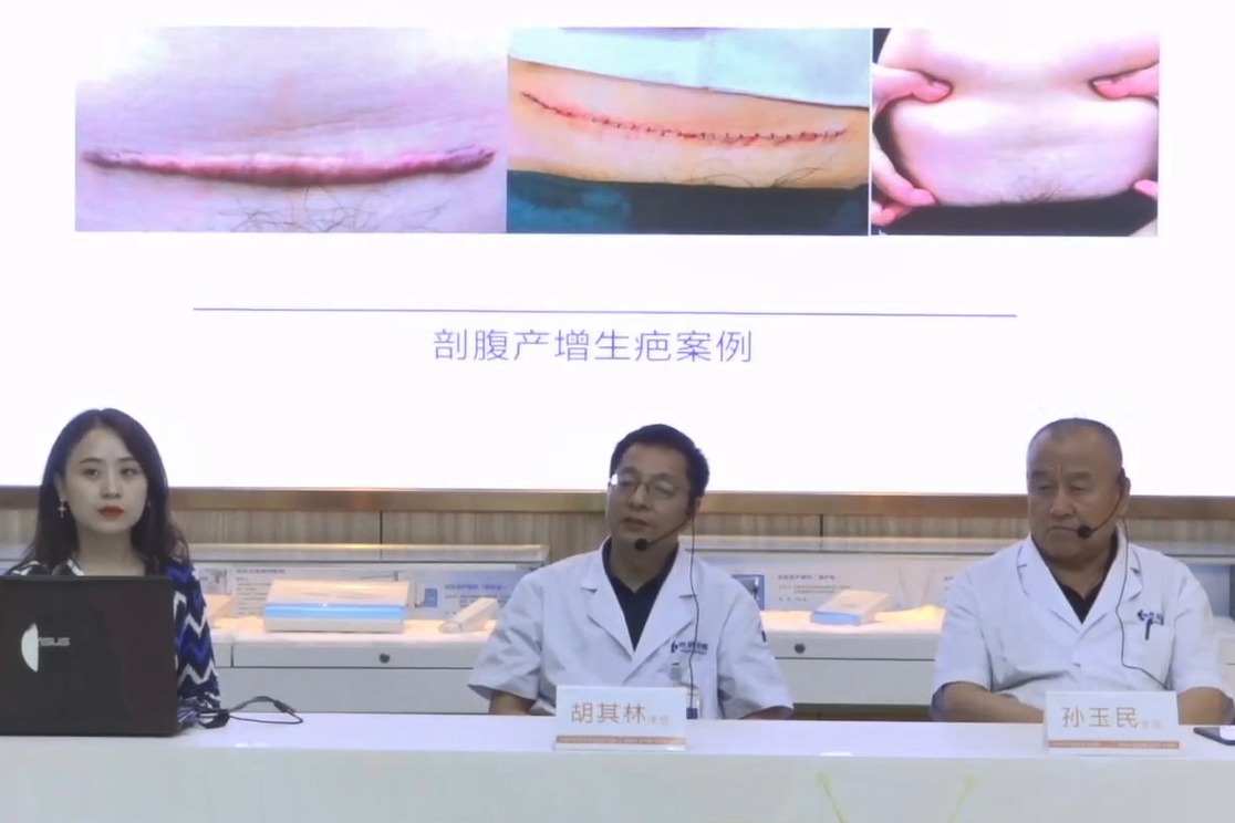 成都疤研疤痕医院治疗剖腹产增生疤效果怎么样