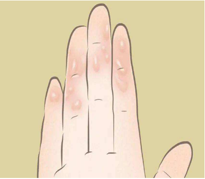 原来手出汗也不是一件简单的事情