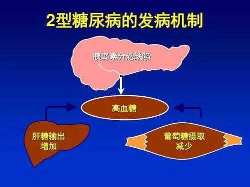 什麼是糖尿病?是怎麼來的?這些常見類型瞭解一下