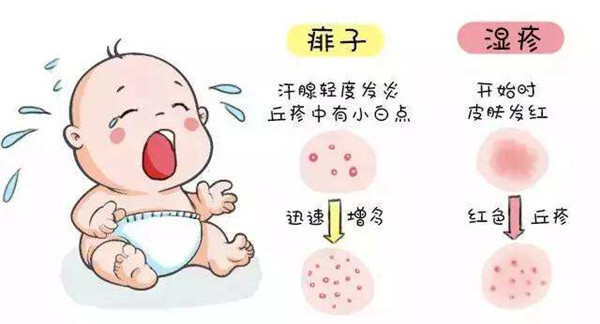 广州供卵三代包男孩（通过试管助孕的婴儿会产生湿疹么?湿疹有哪些常见症状）