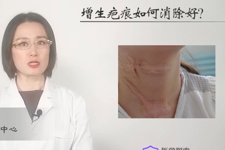 上海长江疤痕医院肖萍:增生疤痕如何治疗?